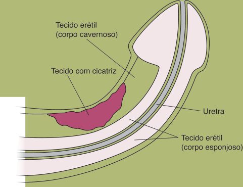 Novo Projeto